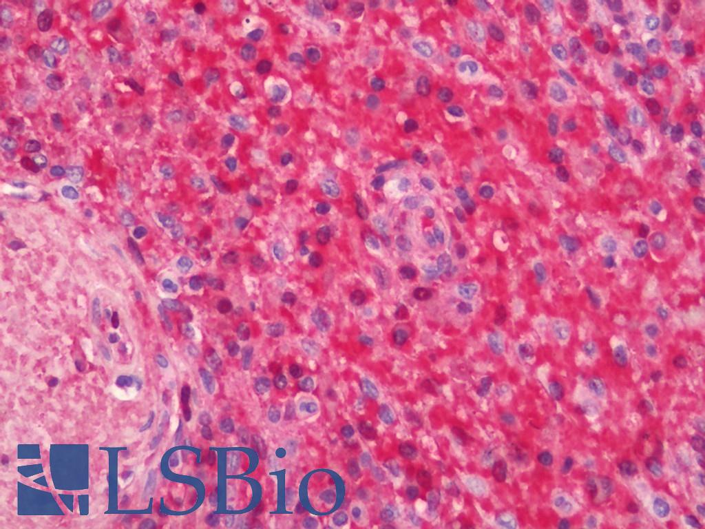 HBZ Antibody - Human Spleen: Formalin-Fixed, Paraffin-Embedded (FFPE)