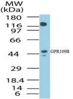 HCAR3 / GPR109B / HM74 Antibody - Western blot of human GPR109B in human liver lysate using antibody at 1 ug/ml.