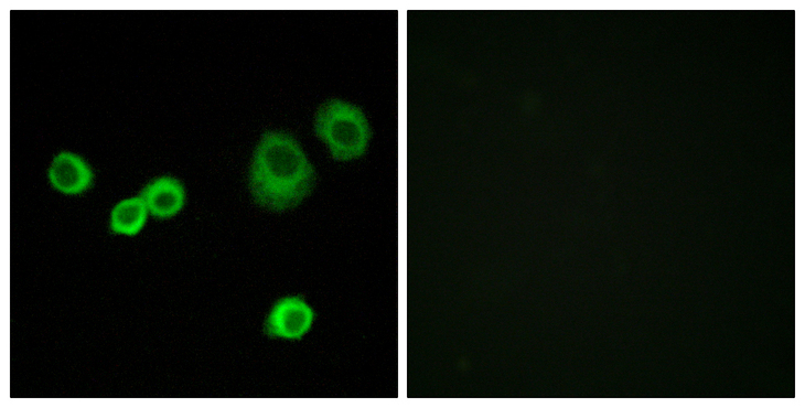 HCCS Antibody - Immunofluorescence analysis of MCF7 cells, using Cytochrome c-type Heme Lyase Antibody. The picture on the right is blocked with the synthesized peptide.