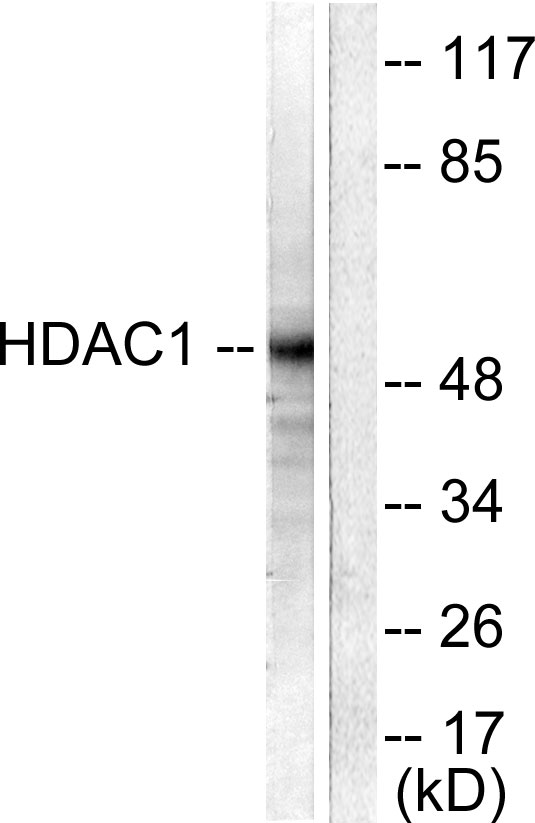 HDAC1 Antibody - Western blot analysis of lysates from NIH/3T3 cells, using HDAC1 Antibody. The lane on the right is blocked with the synthesized peptide.