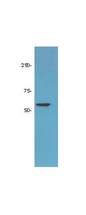 HDAC1 Antibody - Anti-HDAC-1 Antibody - Western Blot.  HDAC1 Antibody was used for Western blot of LNCaP prostate cancer cells. Lysate was loaded at 50 ug per lane and incubated with 1:1000 dilution of primary Ab (Lot. 16248). A band was detected at the expected molecular weight of 55 Kda. Personal communication Flavio Rizzolio, Temple University.