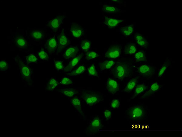 HDAC1 Antibody - Immunofluorescence of monoclonal antibody to HDAC1 on HeLa cell. [antibody concentration 10 ug/ml]