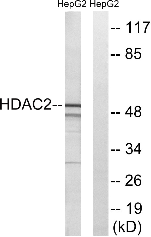 HDAC2 Antibody - Western blot analysis of lysates from HepG2 cells, using HDAC2 Antibody. The lane on the right is blocked with the synthesized peptide.
