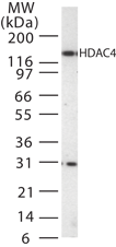 HDAC4 Antibody - Western blot of HDAC-4 in Jurkat cell lysate with antibody.