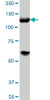 HDAC4 Antibody - Western blot of HDAC4 expression in Jurkat.