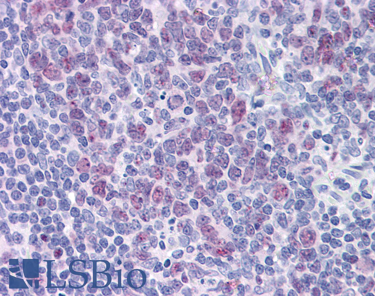 HDAC4 Antibody - Anti-HDAC4 antibody IHC of human tonsil. Immunohistochemistry of formalin-fixed, paraffin-embedded tissue after heat-induced antigen retrieval. Antibody concentration 5 ug/ml.