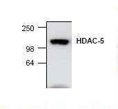 HDAC5 Antibody - Western blot of HDAC5 antibody.