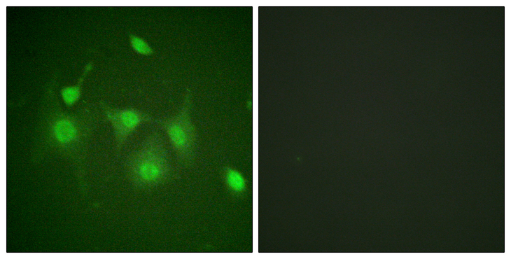 HDAC6 Antibody - Immunofluorescence analysis of HepG2 cells, using HDAC6 Antibody. The picture on the right is blocked with the synthesized peptide.
