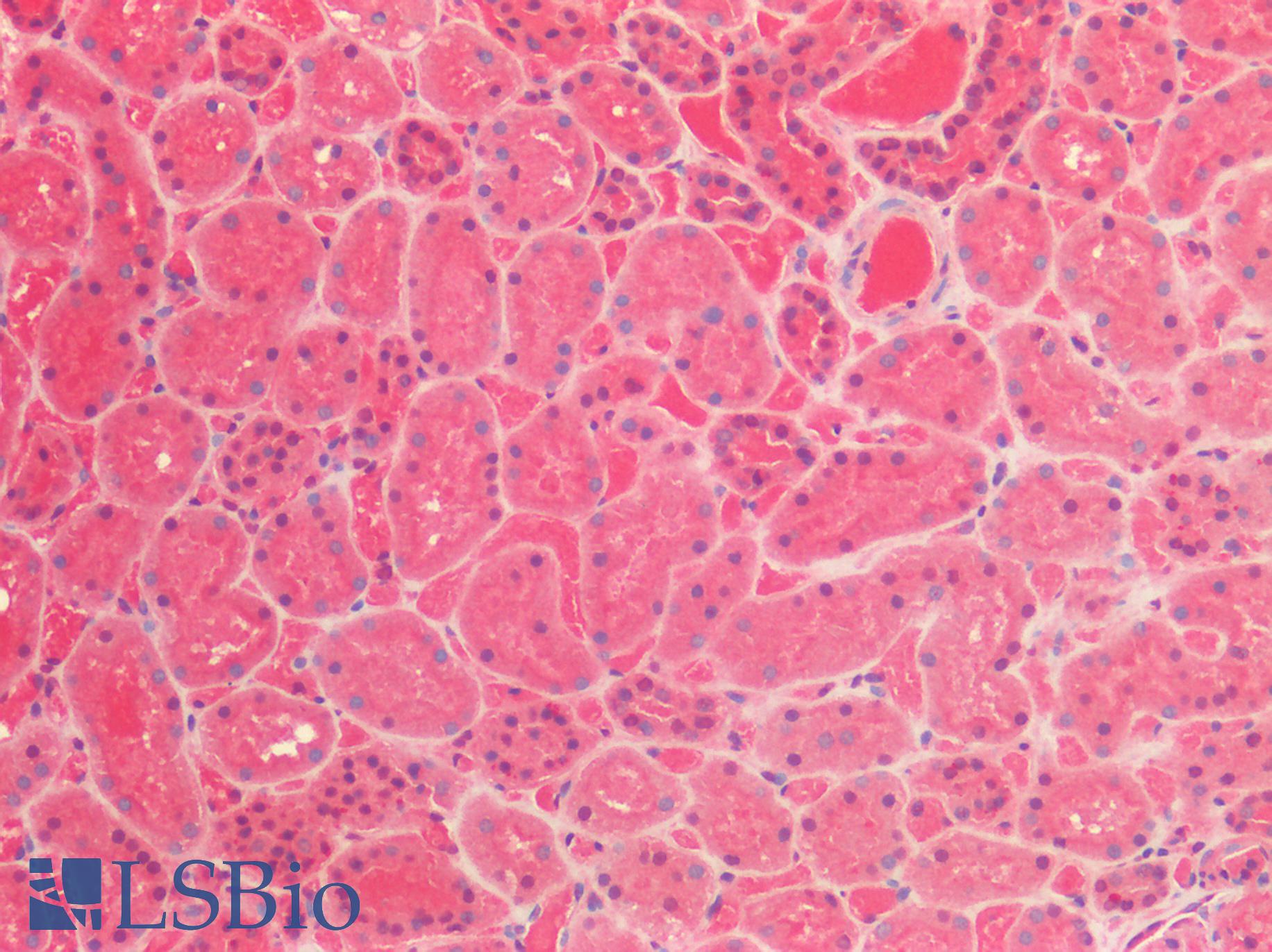 HDAC6 Antibody - Human Kidney: Formalin-Fixed, Paraffin-Embedded (FFPE)