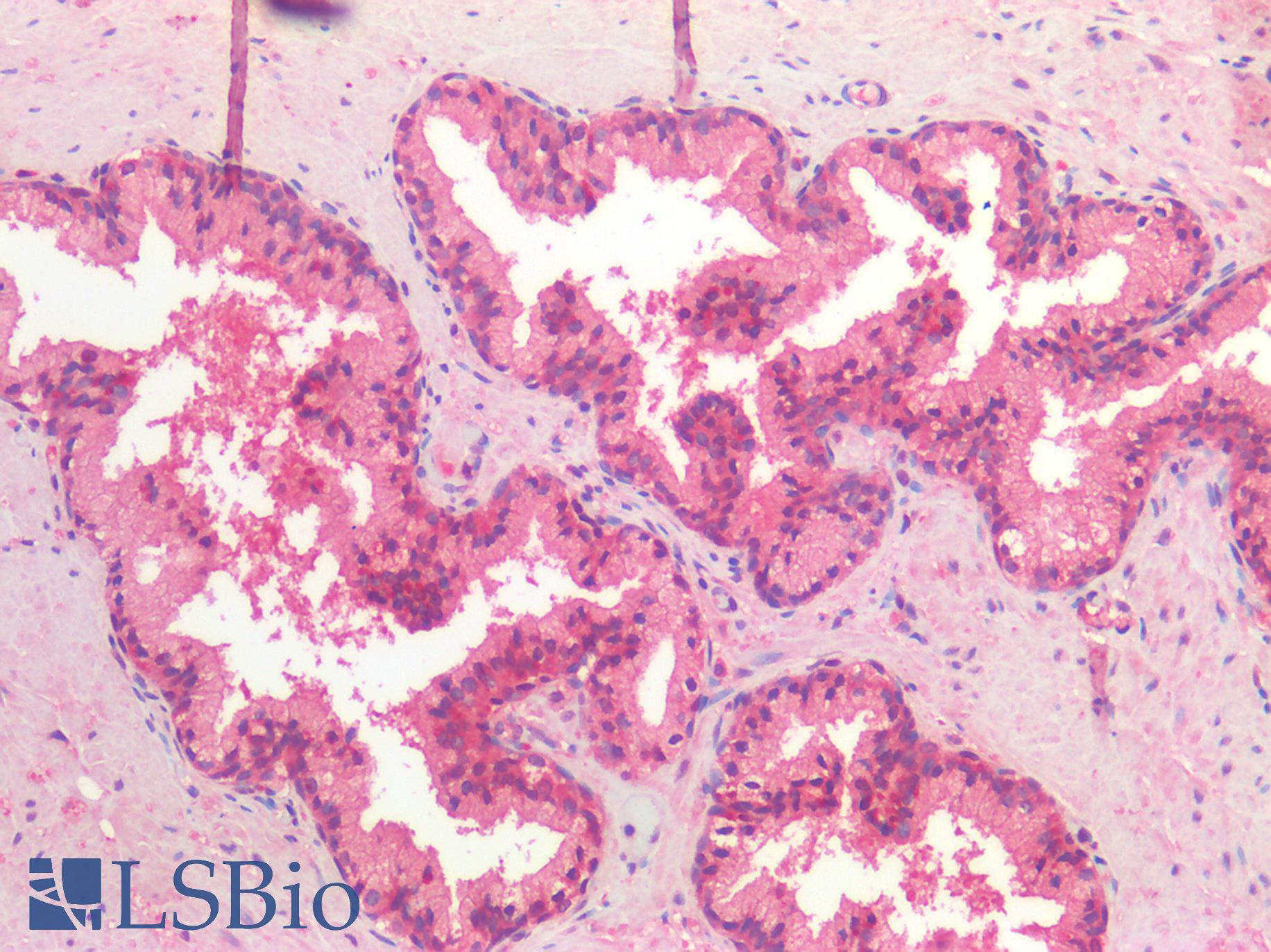 HDAC6 Antibody - Human Prostate: Formalin-Fixed, Paraffin-Embedded (FFPE)