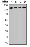 HDAC6 Antibody - Western blot analysis of Histone Deacetylase 6 expression in PC3 (A); Jurkat (B); NIH3T3 (C); rat liver (D) whole cell lysates.