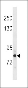 HDGFRP2 Antibody - HDGR2 Antibody western blot of HepG2 cell line lysates (35 ug/lane). The HDGR2 antibody detected the HDGR2 protein (arrow).