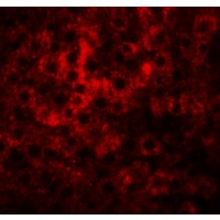 HDGFRP2 Antibody - Immunofluorescence of HDGFRP2 in rat liver tissue with HDGFRP2 antibody at 20 µg/mL.