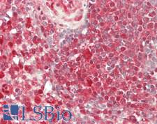 Heat Shock Protein 70 / HSPA1A Antibody - Human Spleen: Formalin-Fixed, Paraffin-Embedded (FFPE)