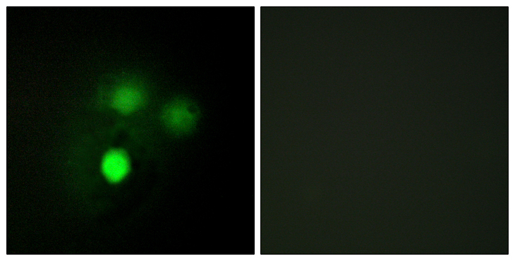 HEC1 / NDC80 Antibody - Immunofluorescence analysis of HUVEC cells, using KNTC2 Antibody. The picture on the right is blocked with the synthesized peptide.