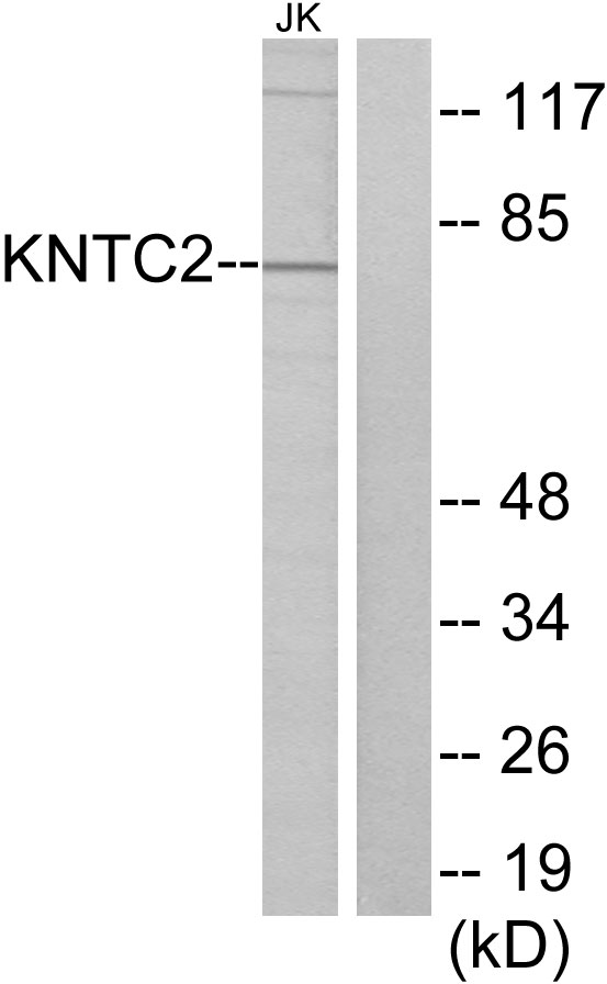 HEC1 / NDC80 Antibody - Western blot analysis of lysates from Jurkat cells, using KNTC2 Antibody. The lane on the right is blocked with the synthesized peptide.