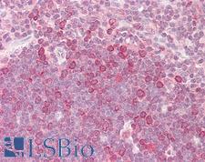 HELO1 / ELOVL5 Antibody - Anti-HELO1 / ELOVL5 antibody IHC of human thymus. Immunohistochemistry of formalin-fixed, paraffin-embedded tissue after heat-induced antigen retrieval. Antibody dilution 10 ug/ml.
