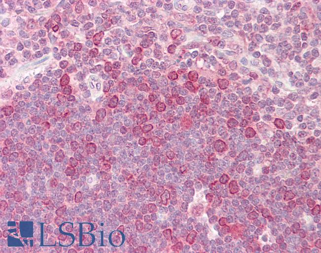HELO1 / ELOVL5 Antibody - Anti-HELO1 / ELOVL5 antibody IHC of human thymus. Immunohistochemistry of formalin-fixed, paraffin-embedded tissue after heat-induced antigen retrieval. Antibody dilution 10 ug/ml.