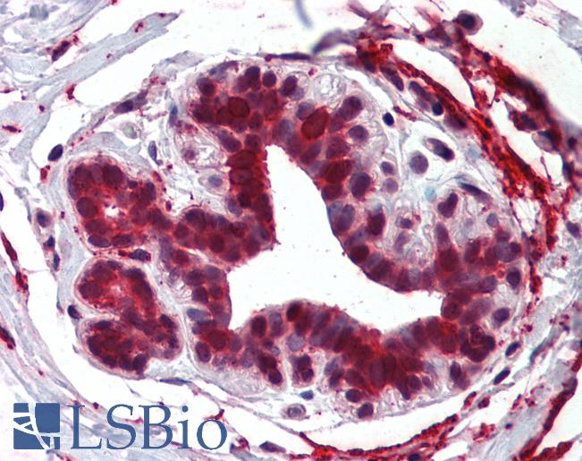 HELO1 / ELOVL5 Antibody - Anti-ELOVL5 antibody IHC of human breast. Immunohistochemistry of formalin-fixed, paraffin-embedded tissue after heat-induced antigen retrieval.
