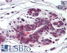 HELO1 / ELOVL5 Antibody - Anti-ELOVL5 antibody IHC of human breast. Immunohistochemistry of formalin-fixed, paraffin-embedded tissue after heat-induced antigen retrieval.