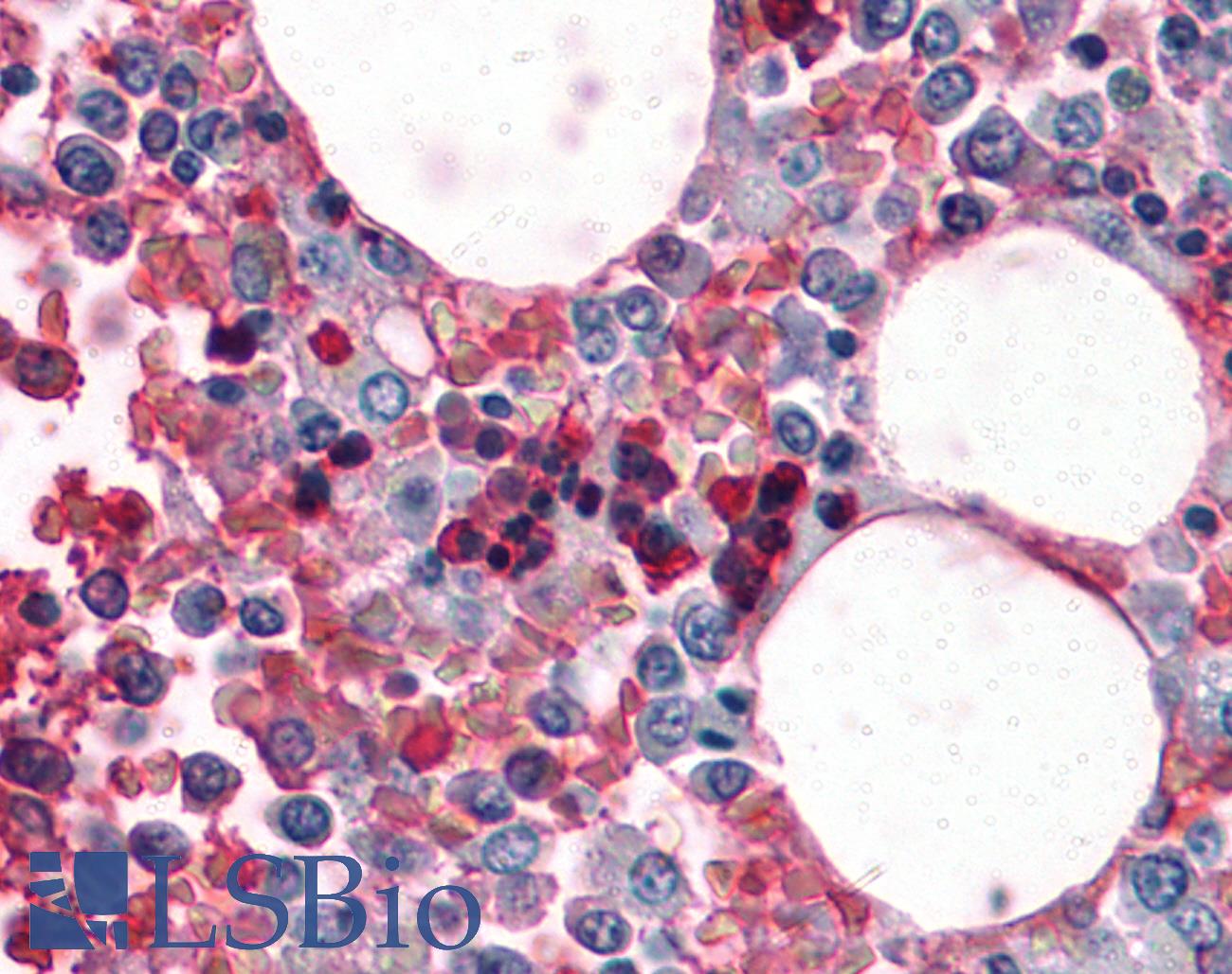 Hemoglobin Antibody - Anti-Hemoglobin antibody IHC of human bone marrow. Immunohistochemistry of formalin-fixed, paraffin-embedded tissue after heat-induced antigen retrieval. Antibody concentration 10 ug/ml.