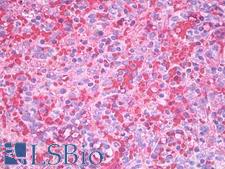 Hemoglobin Antibody - Anti-Hemoglobin antibody IHC of human spleen, erythrocytes. Immunohistochemistry of formalin-fixed, paraffin-embedded tissue after heat-induced antigen retrieval. Antibody dilution 10 ug/ml.