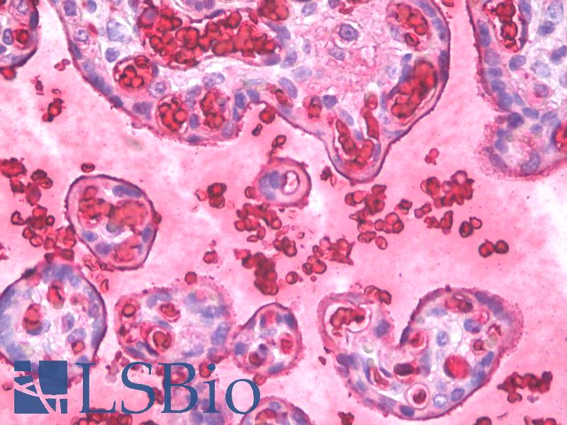 Hemoglobin Antibody - Anti-Hemoglobin antibody IHC of human placenta, erythrocytes. Immunohistochemistry of formalin-fixed, paraffin-embedded tissue after heat-induced antigen retrieval. Antibody dilution 10 ug/ml.