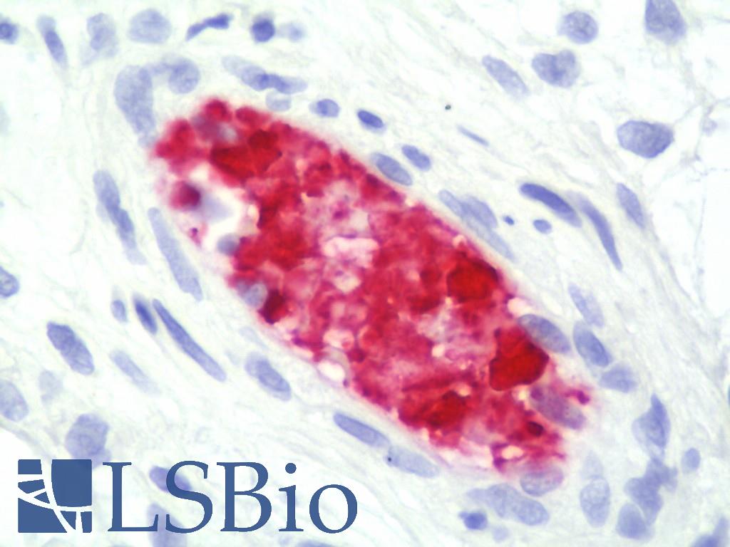 Hemoglobin Antibody - Anti-Hemoglobin antibody IHC staining of human placenta. Immunohistochemistry of formalin-fixed, paraffin-embedded tissue after heat-induced antigen retrieval. Antibody concentration 10 ug/ml.