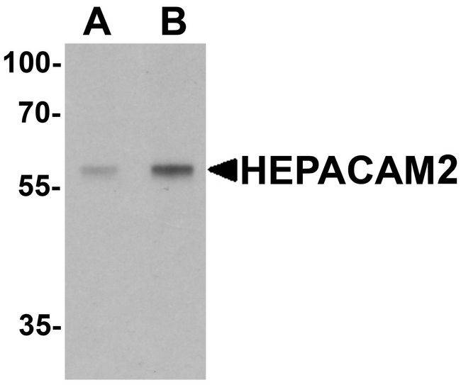 HEPACAM2 Antibody - Western blot analysis of HEPACAM2 in mouse brain tissue lysate with HEPACAM2 antibody at (A) 0.5 ug/ml and (B) 1 ug/ml.