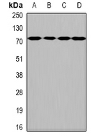 Heparanase 2 / HPSE2 Antibody - Western blot analysis of HPA2 expression in HeLa (A); SKOV3 (B); mouse brain (C); rat brain (D) whole cell lysates.