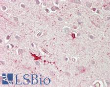 Heparanase 2 / HPSE2 Antibody - Human Brain, Cortex: Formalin-Fixed, Paraffin-Embedded (FFPE)