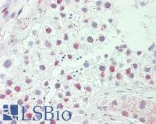 HEPHL1 Antibody - Anti-HEPHL1 antibody IHC staining of human testis. Immunohistochemistry of formalin-fixed, paraffin-embedded tissue after heat-induced antigen retrieval. Antibody dilution 1:100.
