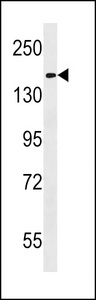 HEPHL1 Antibody - HEPHL1 Antibody western blot of K562 cell line lysates (35 ug/lane). The HEPHL1 antibody detected the HEPHL1 protein (arrow).