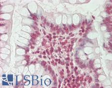 HERC2 Antibody - Human Small Intestine: Formalin-Fixed, Paraffin-Embedded (FFPE)