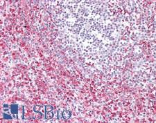 HERC6 Antibody - Human Spleen: Formalin-Fixed, Paraffin-Embedded (FFPE)