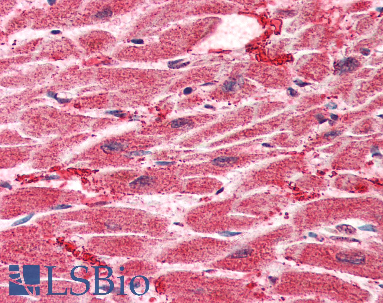 HES1 / HES-1 Antibody - Anti-HES1 antibody IHC of human heart. Immunohistochemistry of formalin-fixed, paraffin-embedded tissue after heat-induced antigen retrieval. Antibody concentration 5 ug/ml.