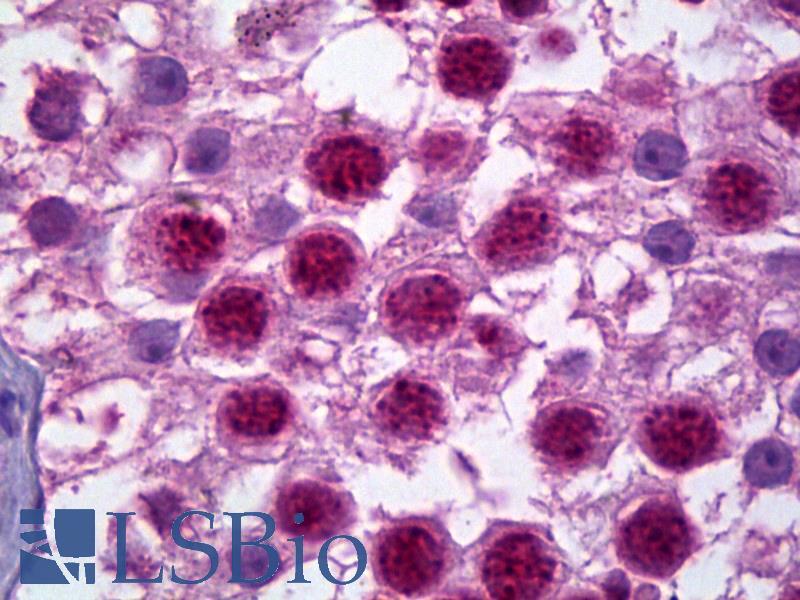 HES1 / HES-1 Antibody - Anti-HES1 antibody IHC of human testis. Immunohistochemistry of formalin-fixed, paraffin-embedded tissue after heat-induced antigen retrieval. Antibody concentration 2.5 ug/ml.