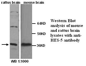 HES5 Antibody - Western blot analysis on Rat Brain and Mouse Brain lysates using rabbit polyclonal antibody to HES5.