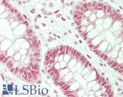 HES6 Antibody - Human Colon: Formalin-Fixed, Paraffin-Embedded (FFPE)
