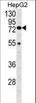 HEXA Antibody - Western blot of HEXA Antibody in HepG2 cell line lysates (35 ug/lane). HEXA (arrow) was detected using the purified antibody.