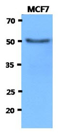 HEXA Antibody - Western Blot: The cell lysates of MCF7 (40 ug) were resolved by SDS-PAGE, transferred to PVDF membrane and probed with anti-human HEXA antibody (1:3000). Proteins were visualized using a goat anti-mouse secondary antibody conjugated to HRP and an ECL detection system.