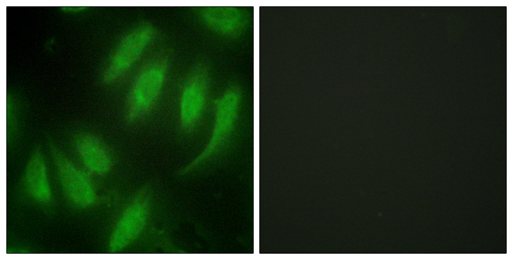 HEXIM1 Antibody - Immunofluorescence analysis of HeLa cells, using HEXIM1 Antibody. The picture on the right is blocked with the synthesized peptide.