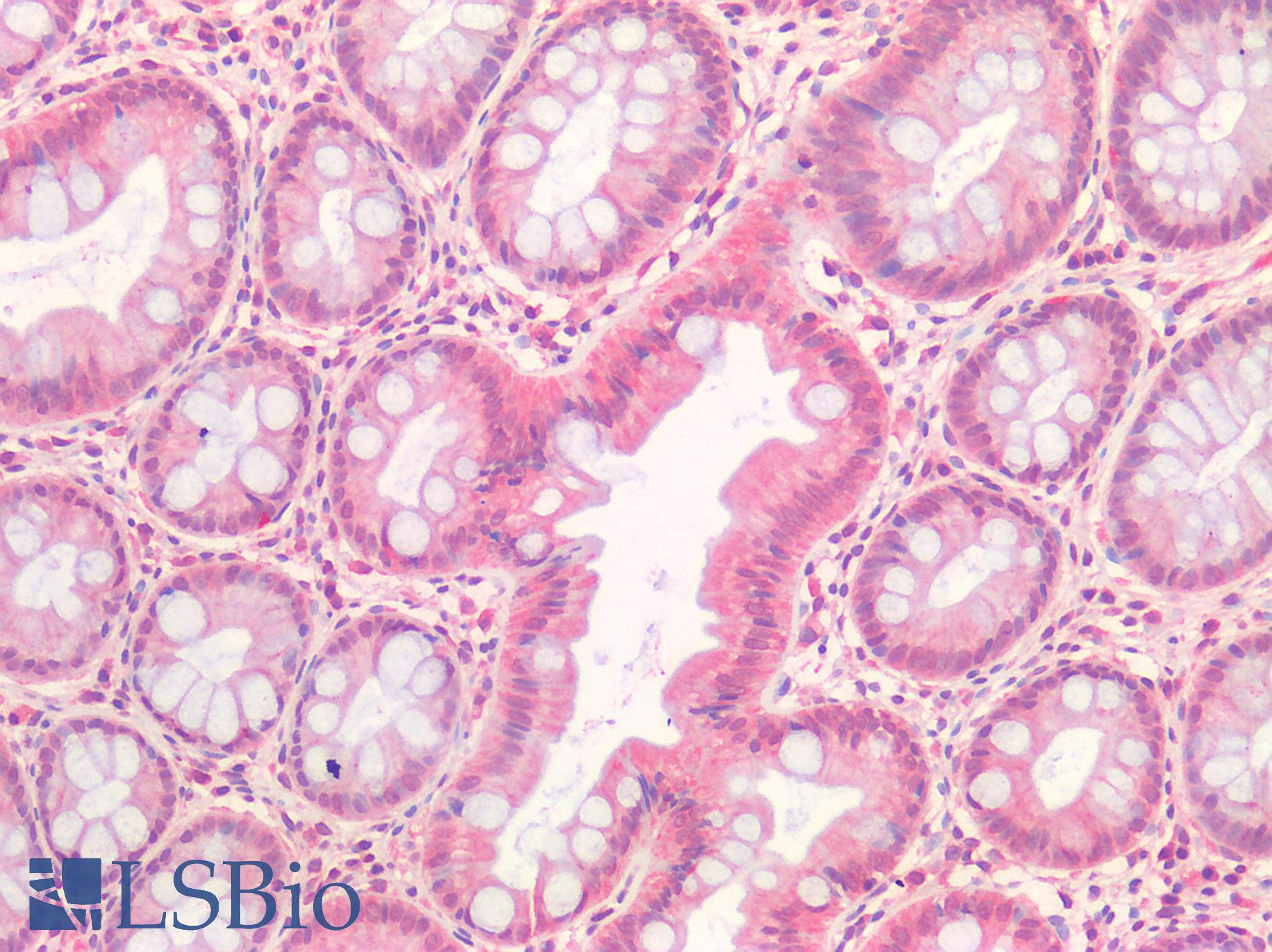 HGF / Hepatocyte Growth Factor Antibody - Human Colon: Formalin-Fixed, Paraffin-Embedded (FFPE)