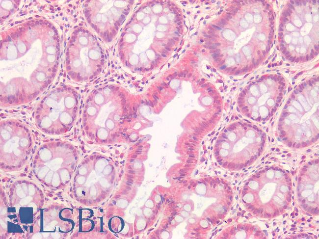 HGF / Hepatocyte Growth Factor Antibody - Human Colon: Formalin-Fixed, Paraffin-Embedded (FFPE)