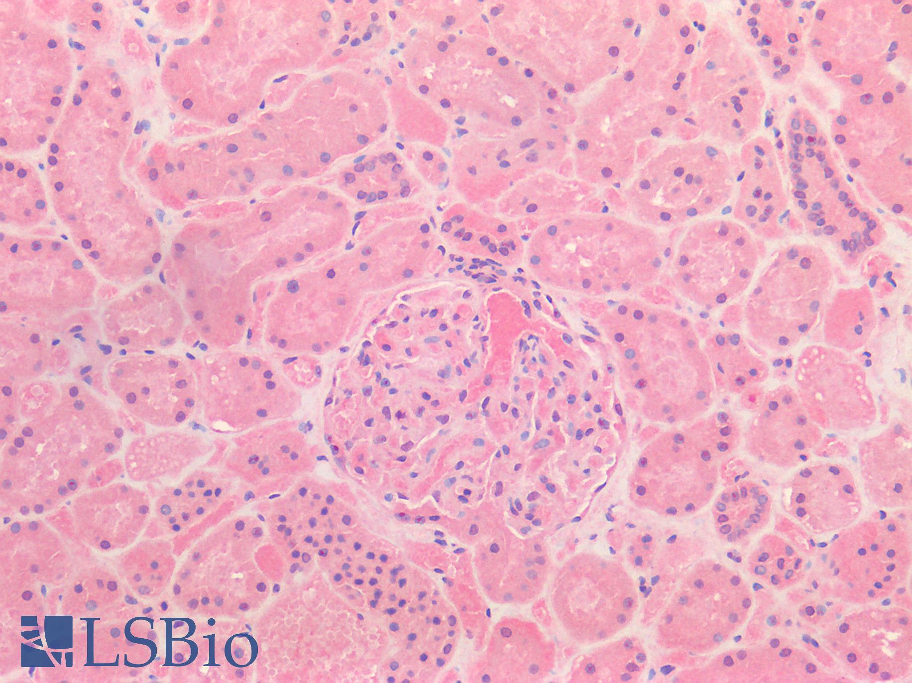 HGF / Hepatocyte Growth Factor Antibody - Human Kidney: Formalin-Fixed, Paraffin-Embedded (FFPE)