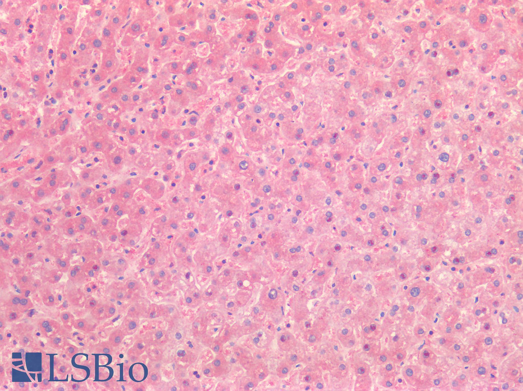 HGF / Hepatocyte Growth Factor Antibody - Human Liver: Formalin-Fixed, Paraffin-Embedded (FFPE)