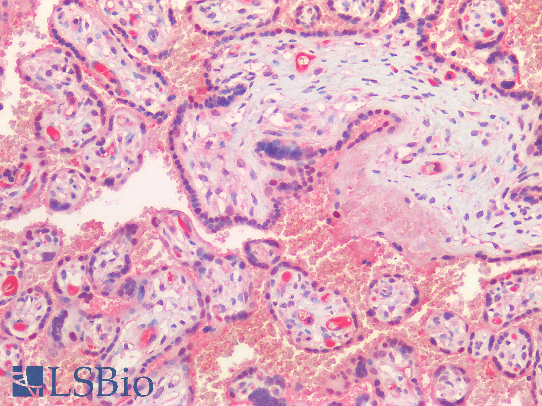 HGF / Hepatocyte Growth Factor Antibody - Human Placenta: Formalin-Fixed, Paraffin-Embedded (FFPE)