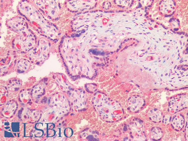 HGF / Hepatocyte Growth Factor Antibody - Human Placenta: Formalin-Fixed, Paraffin-Embedded (FFPE)