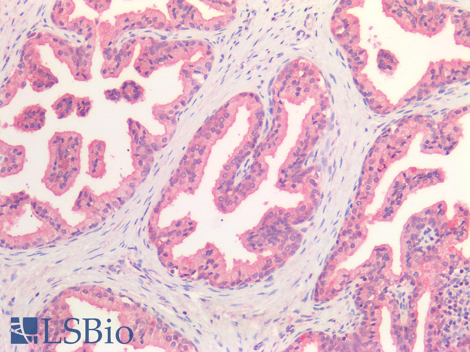 HGF / Hepatocyte Growth Factor Antibody - Human Prostate: Formalin-Fixed, Paraffin-Embedded (FFPE)