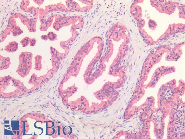 HGF / Hepatocyte Growth Factor Antibody - Human Prostate: Formalin-Fixed, Paraffin-Embedded (FFPE)